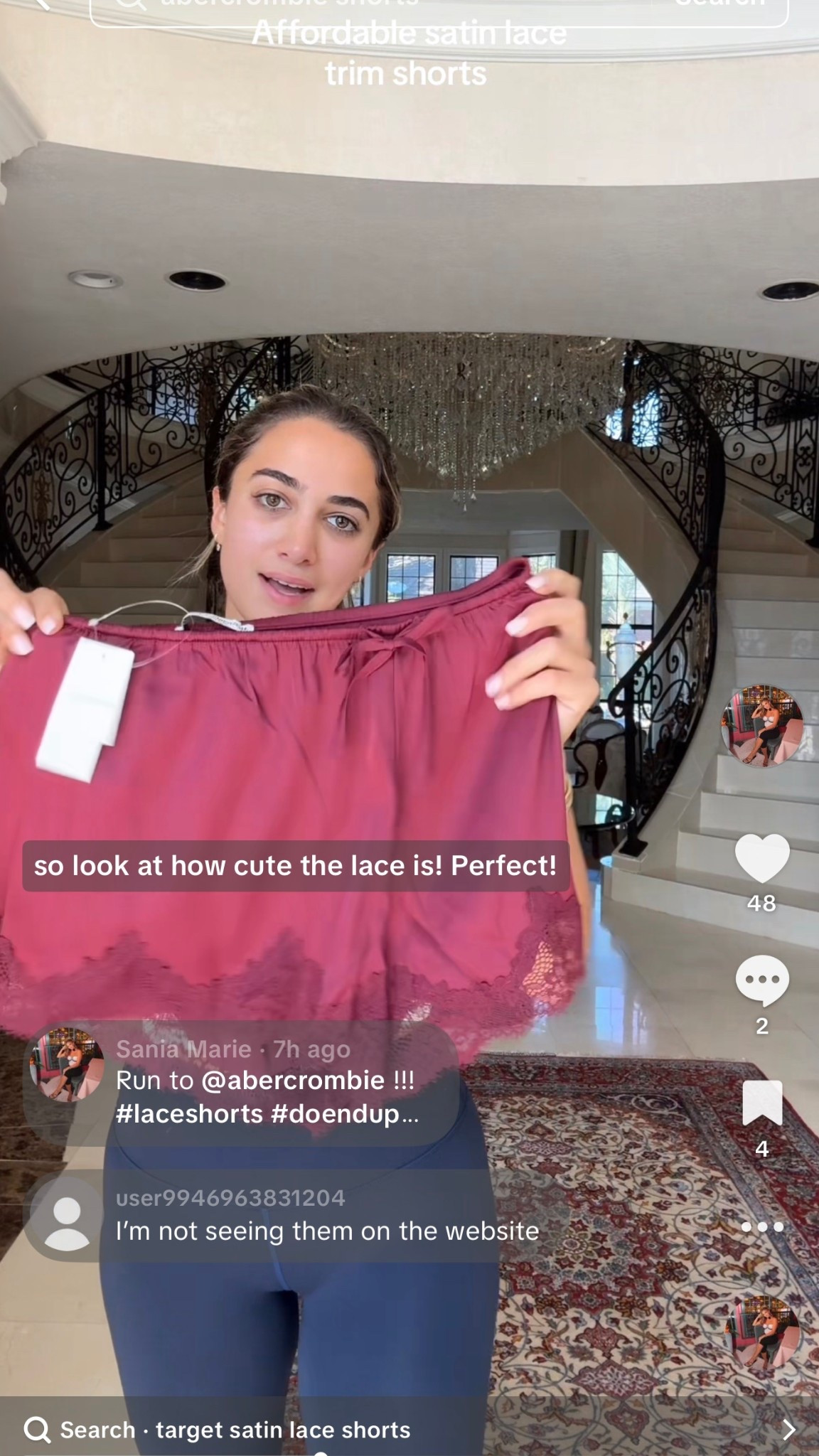 The most amazing lace trim shorts! 