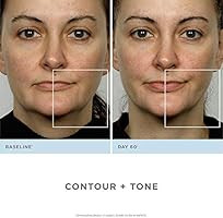 NuFACE Advanced Facial Toning Kit, Trinity Facial Trainer Device + Hydrating Leave-On Gel Primer,... | Amazon (US)