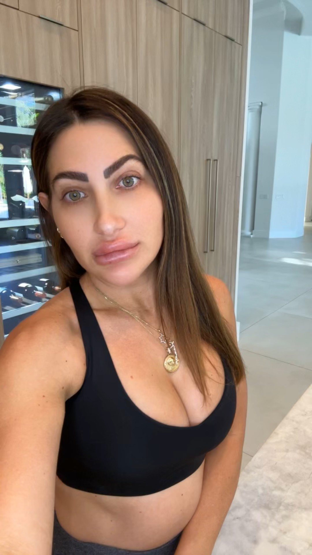 These are the daily things I do to stay healthy with probiotics and vitamins, especially with gut health problems on the rise

Part 1