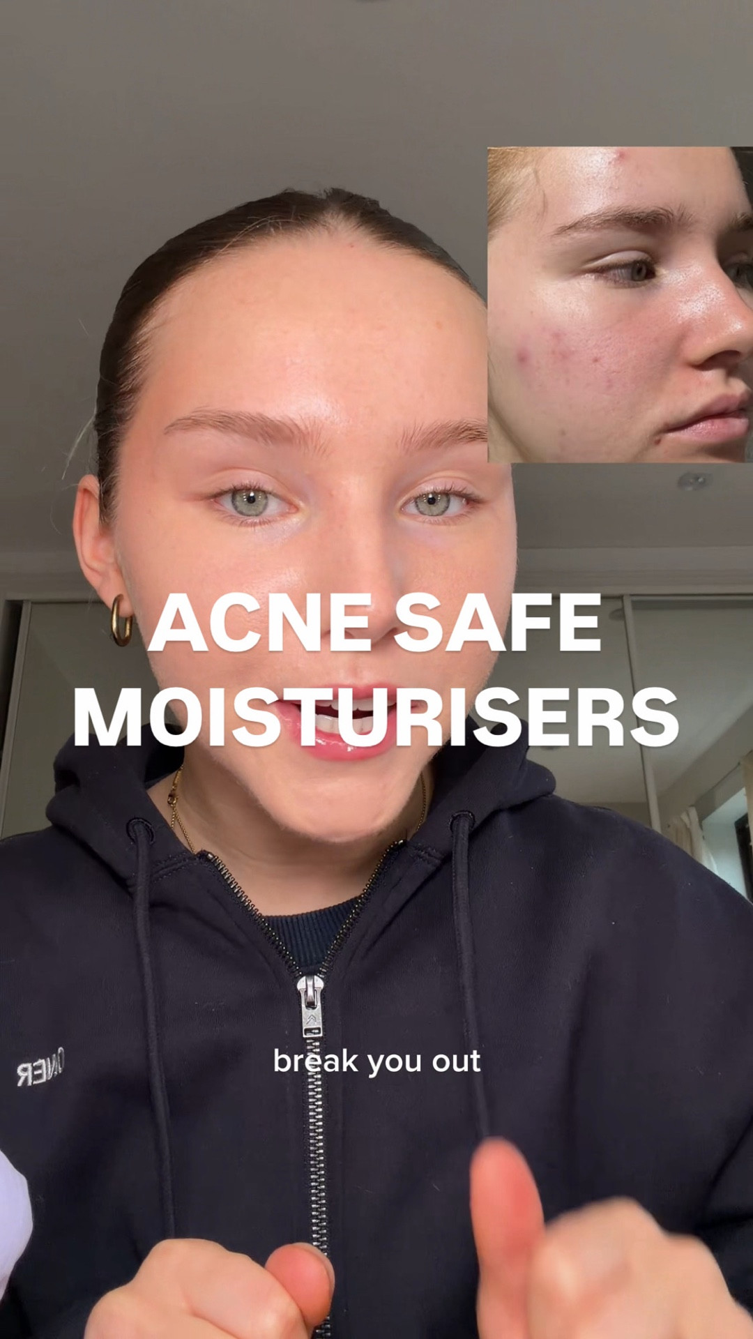ACNE SAFE MOISTURISERS⭐️
DISCOUNT CODES: use LIFEWITHMILS on Dr Sam’s and YesStyle💕

#LTKbeauty