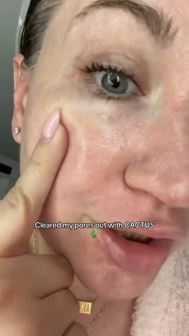 Large pores looked smaller after cactox infused peel shot #beauty #ad

https://www.tiktok.com/@holistic.wellness.glow/video/7624300492797119758?is_from_webapp=1&sender_device=pc&web_id=7595868255789630984 

 