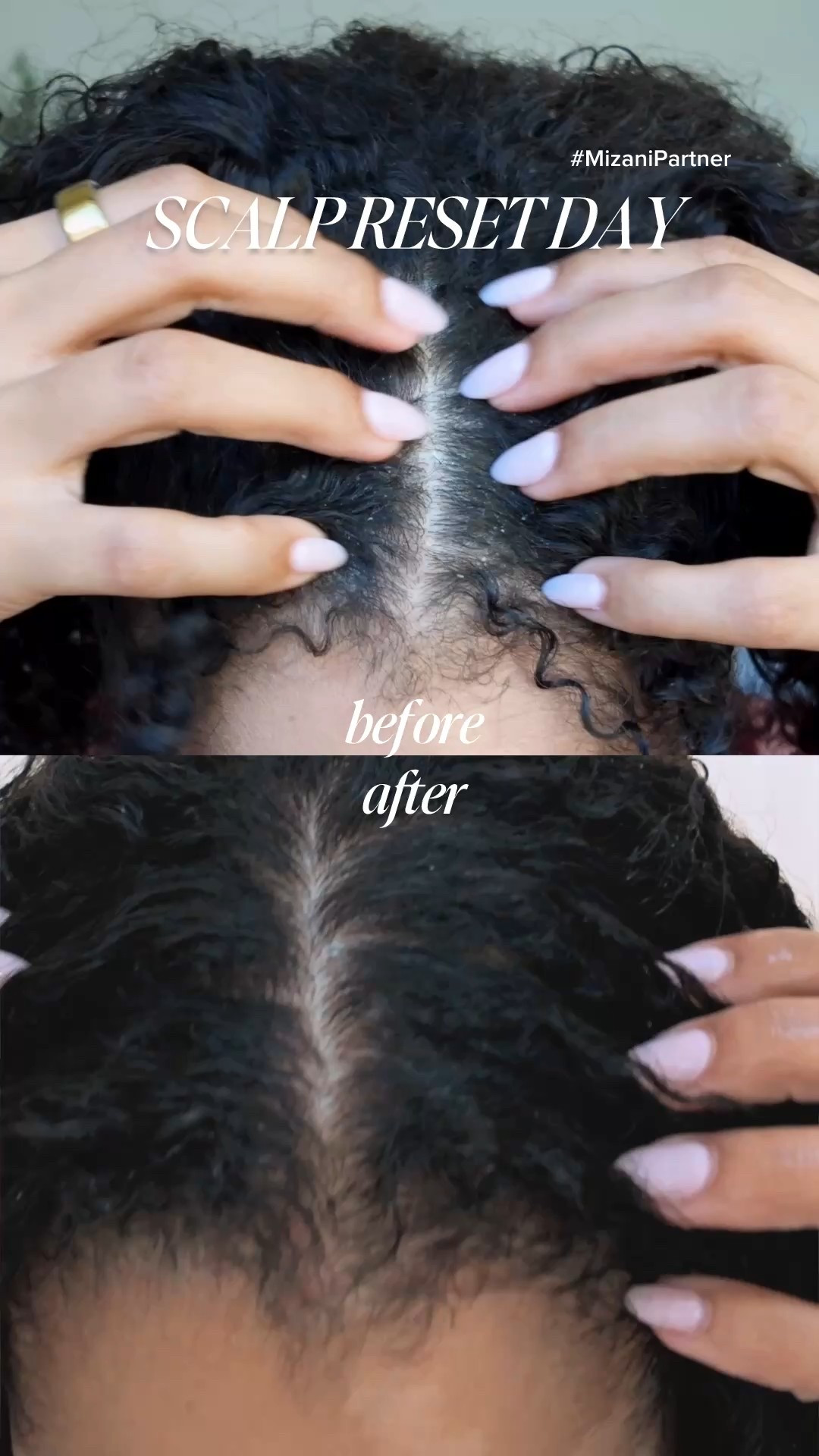 Scalp & Hair Reset Day using @Mizani’s Wonder Crown to clear out the buildup after an active week 🙌🏽 Treats the scalp, helps nourish and reduce breakage of the hair — 10/10. You can grab your #Mizani restocks on Amazon & I’ve linked more of my faves from them just in case 🤗 #MizaniPartner


#LTKBeauty #LTKselfcare