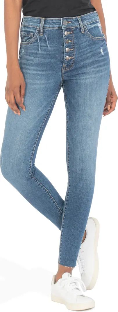 Donna Fab Ab Button Fly High Waist Ankle Skinny Jeans | Nordstrom