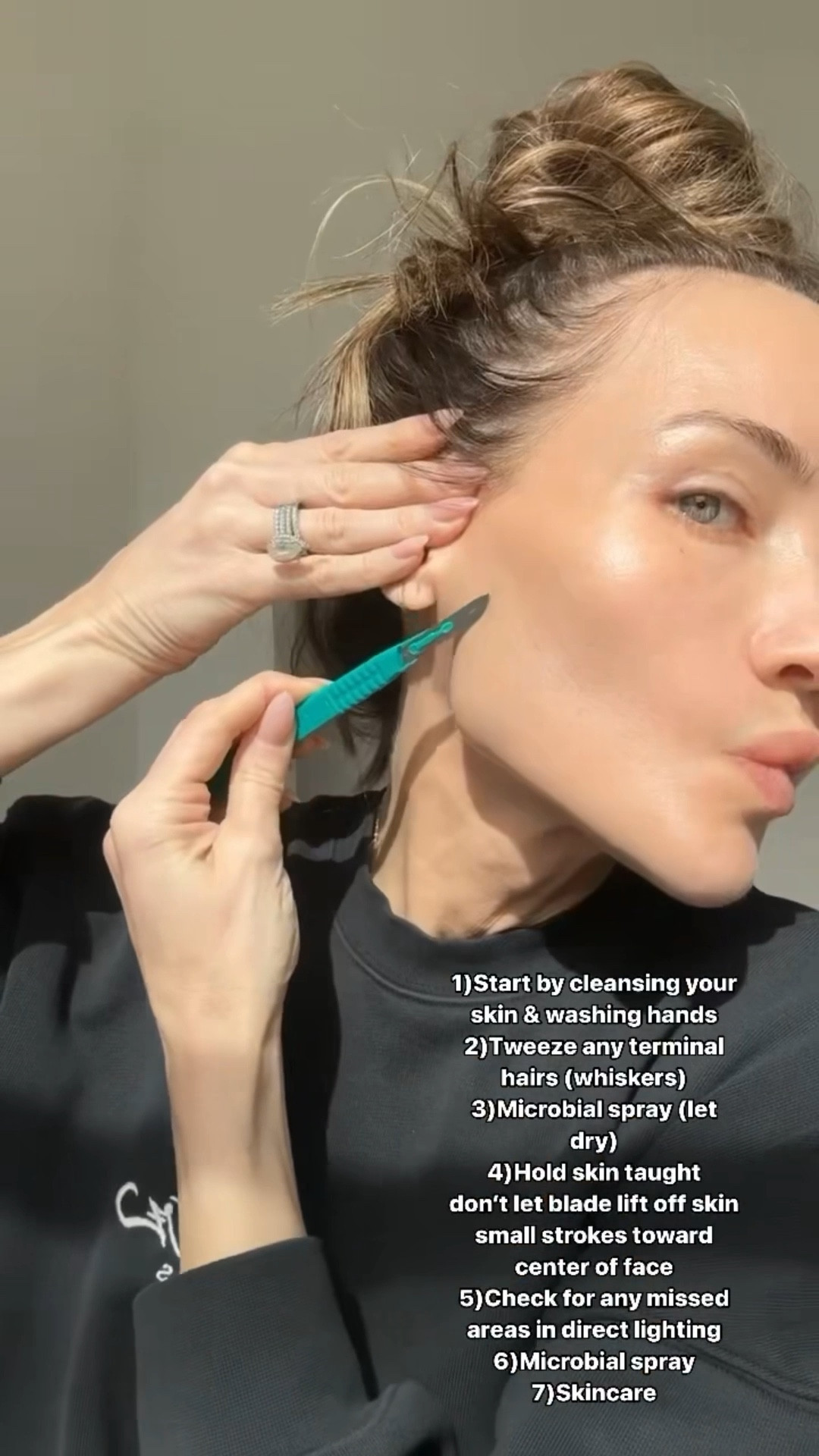 Dermaplaning isn't just about removing peach fuzz, it's a gentle form of exfoliation that helps reveal new, healthy skin underneath.
Benefits include better skincare absorption and it gives the smoothest canvas for your makeup to sit on.
Pro Tip: leave the blade on the skin with light pressure and use short strokes. I'm using a scalpel but I highly suggest dermablading tools with guards which l've linked. If you feel unsure, it is best to see an esthetician.
This is my favorite thing to do 7 days post treatment to remove dead skin!
1️⃣Start by cleansing your skin & washing hands
2️⃣Tweeze any terminal hairs (whiskers)
3️⃣Microbial spray (let dry)
4️⃣Hold skin taunt don't let blade lift off skin small strokes toward center of face
5️⃣Check for any missed areas in direct lighting
6️⃣Microbial spray
7️⃣Skincare

#LTKValentine #LTKgrwm #LTKdayinmylife