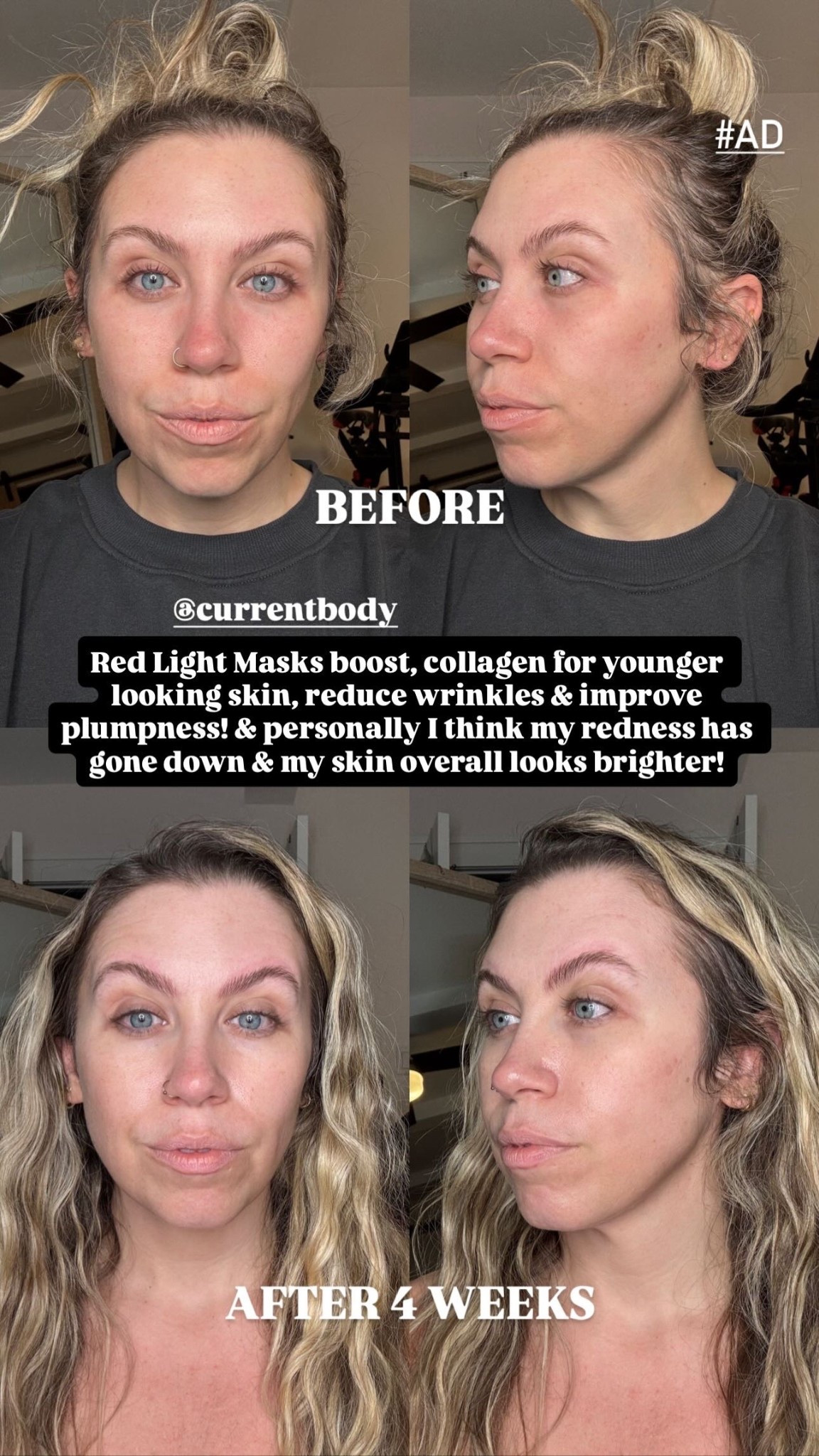 The best LED red light therapy mask on the market! CurrentBody Series 2 LED red light therapy mask’s LEDs are evenly distributed and precisely spaced across the face for the best results! USE CODE: JACKIELED for 10% off

#LTKOver40 #LTKSaleAlert #LTKBeauty