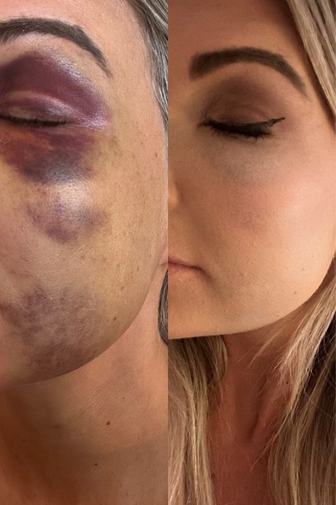 post wreck coverage!
tarte code: KTSMITH