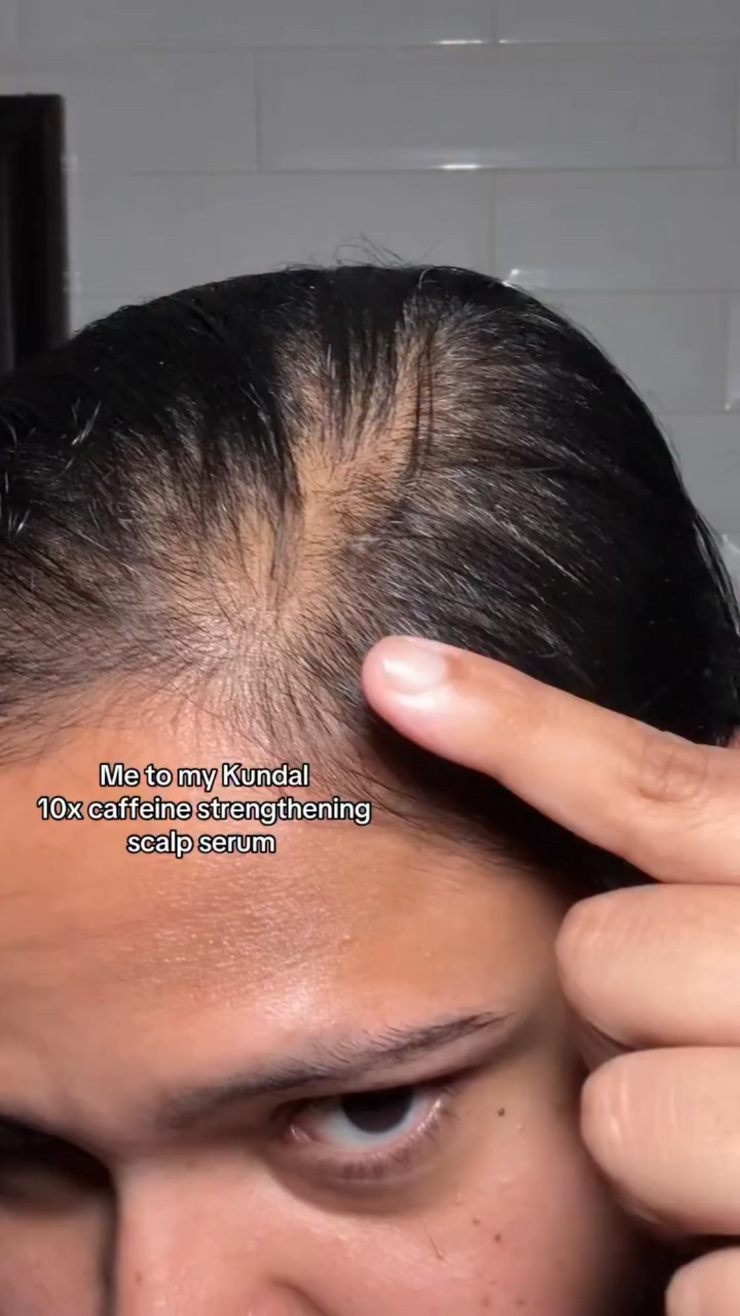 Manifesting this @kundal.official 10x caffeine strengthening scalp serum will work.
It’s minoxidil free and now available on @amazon @amazonbeauty  Will share the results soon. 
#KUNDAL #hairloss #scalpserum #hairgrowth #caffeinescalpserum #amazonbeautyfinds #amazon #amazonbeauty #haircare