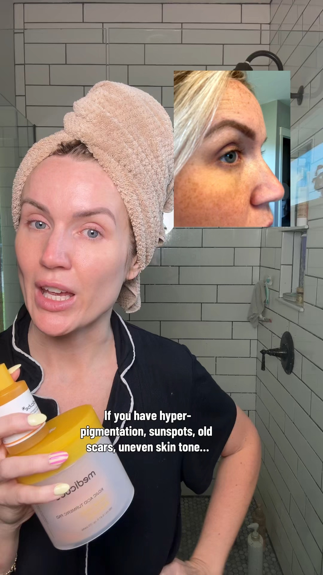 👋🏼 dark spots!

#LTKBeauty #LTKSaleAlert #LTKselfcare