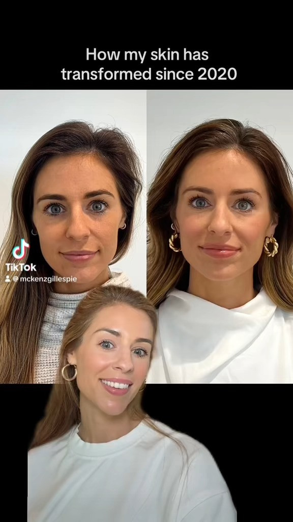 The skincare that has transformed my skin along with going to Skin Pharm :)

 

 #LTKBeauty