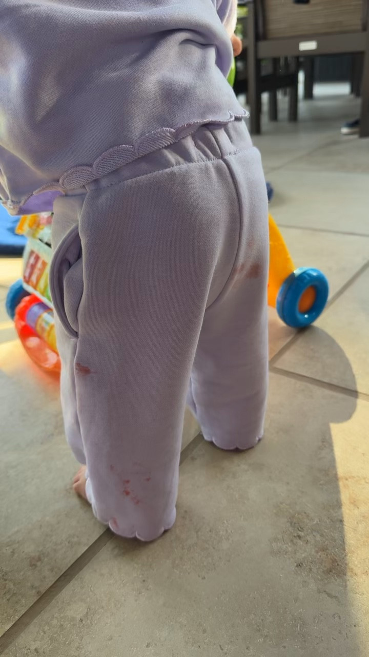 I really even couldn’t believe how good this product worked until today. Literal magic when it comes to stain remover. A mom must have!



#LTKBaby #LTKKids #LTKmomlife