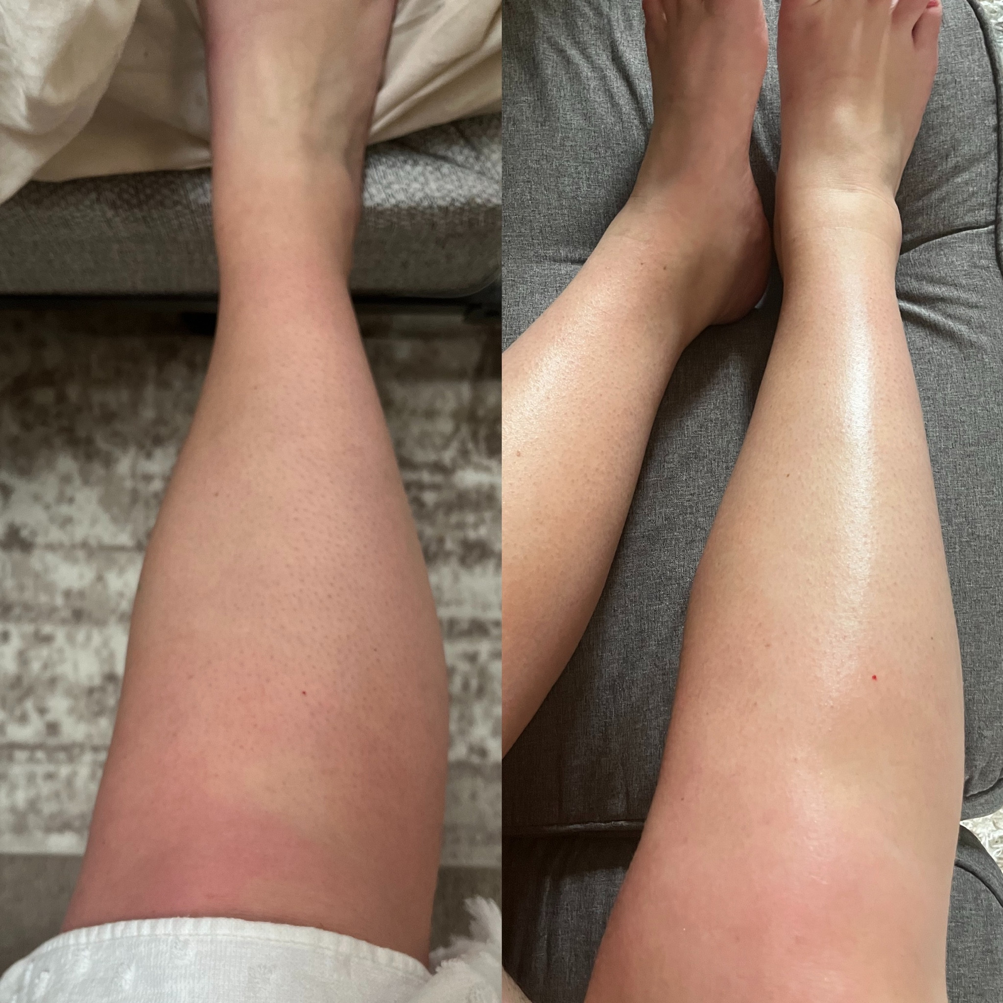 Maybe the weirdest pic I’ve posted on LTK. But you guys. The Jergens melanin glow lotion is a game changer. A summer staple. This is right before and then about 5 minutes after applying. Look at that leg shine ✨ I picked this up from Target for under 10 bucks!! Such a beautiful subtle glow. To enhance this, I would add the Jergens tanning mousse the night before, rinse the next day then apply. 

#LTKbeauty #LTKswim #LTKSeasonal
