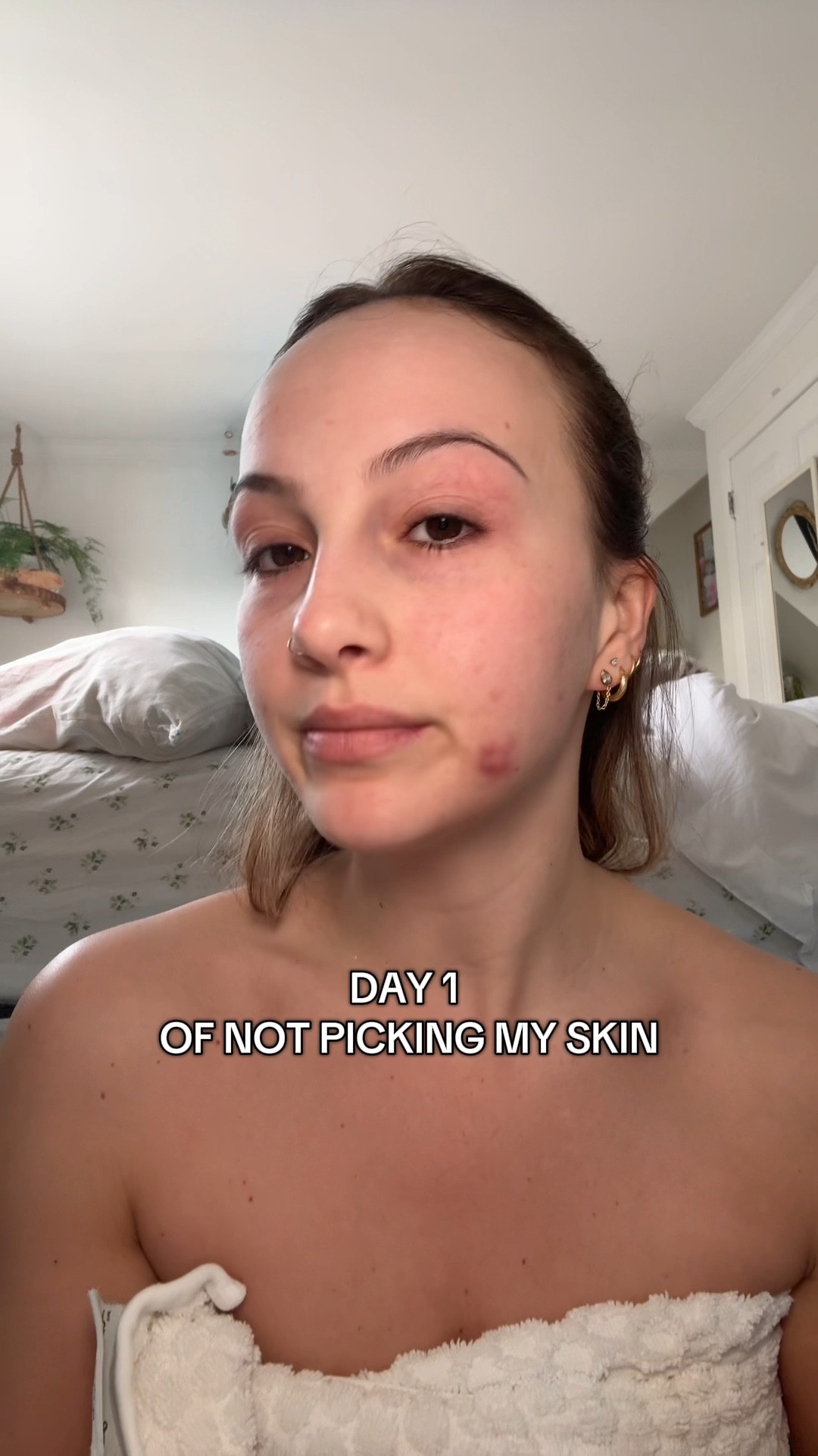 my acne safe skin care routine! 

#LTKBeauty #LTKWatchNow #LTKU