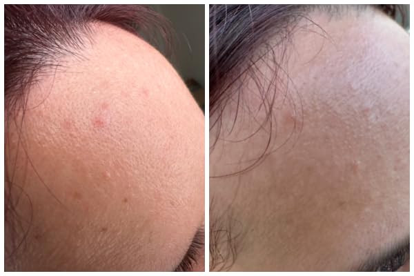 TIRTIR Milk Skin Rice Toner - Deep Moisturizing, Hydrating and Refreshing for face, Niacinamide, ... | Amazon (US)