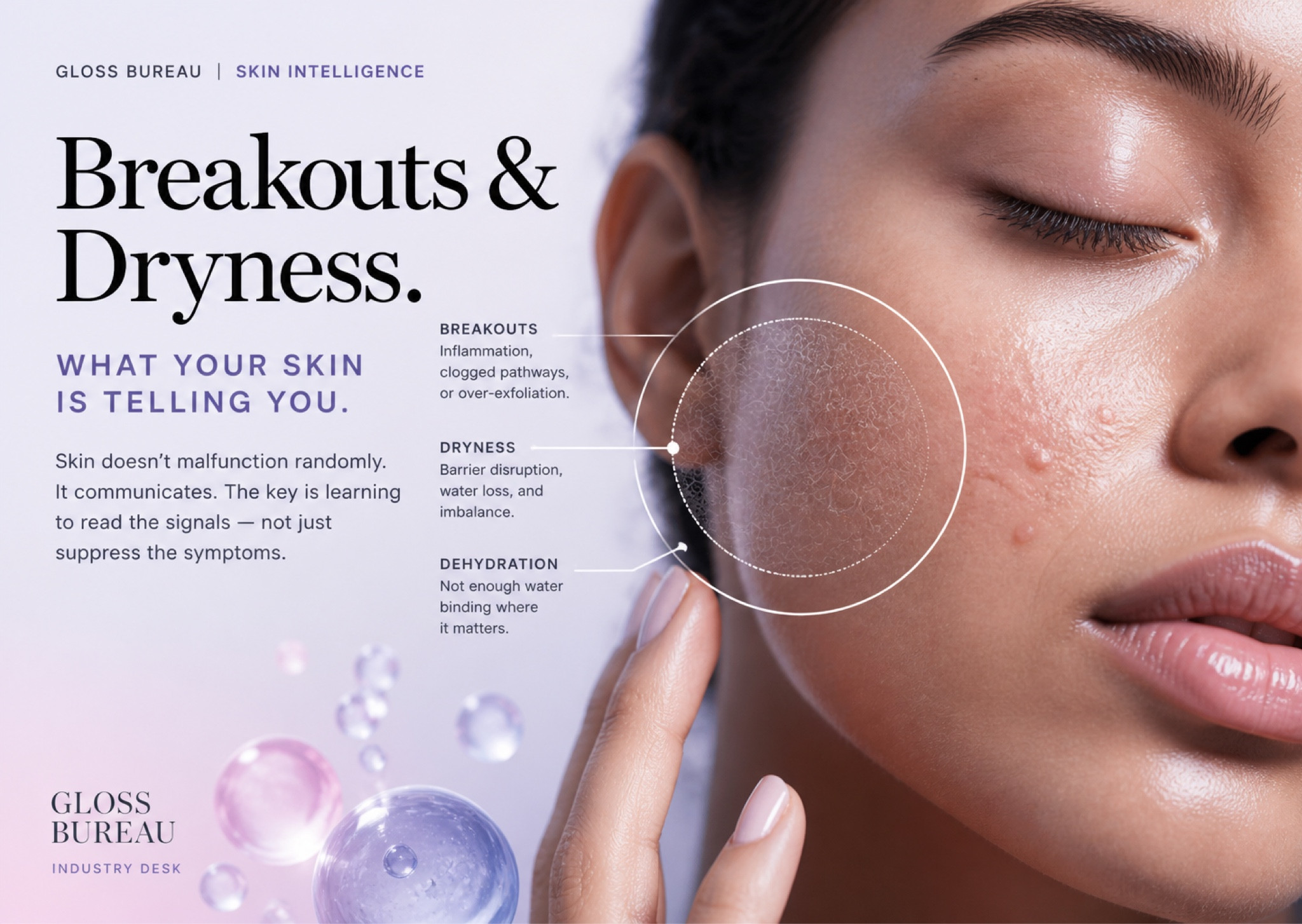 Have you ever noticed your skin struggling with breakouts and dryness at the same time? It can feel like a paradox, but it’s actually a clear sign of barrier disruption.
Instead of just layering on more products to "fix" the symptoms, take a breath and look at the signals. From inflammation to water loss, your skin is trying to tell you exactly what it needs to get back into balance.
Read the full breakdown on the blog to learn how to stop suppressing and start supporting your skin barrier.
#SkinIntelligence #SkinBarrierRepair #SkincareScience #GlossBureau