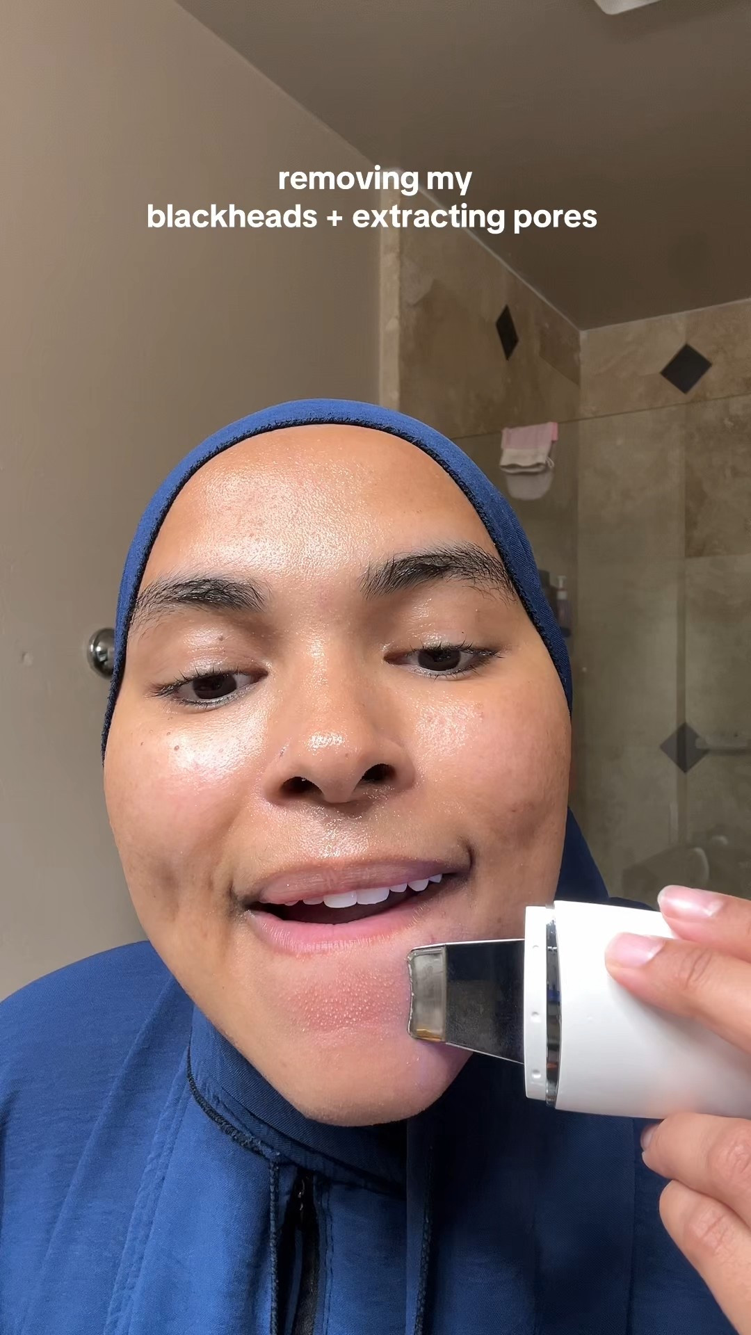 This has been the newest edition to my skincare routine and I love it ! 