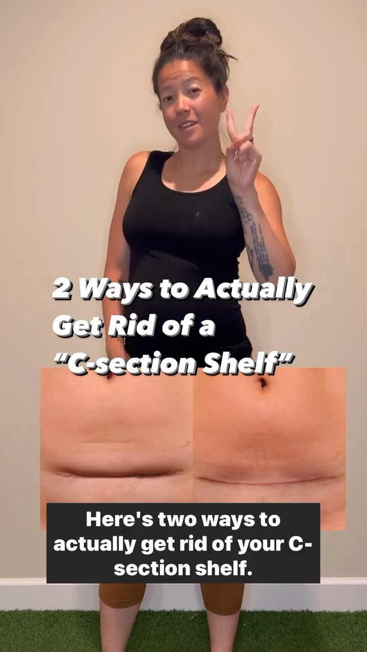 C-section recovery!!  Here are our top items and tips to support your recovery after a C-section. #csection 