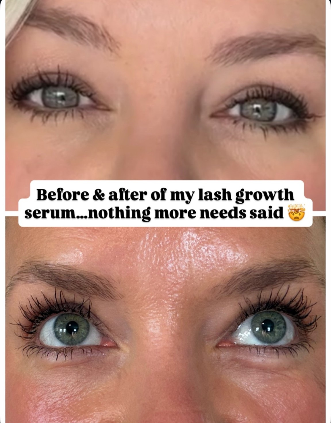 Nothing changed my lashes more than THIS lash growth serum! I've tried several & some do work, but none have worked quite like this one! I do the growth serum at night & the conditioning serum in the morning.

#LTKselfcare #LTKOver40 #LTKBeauty