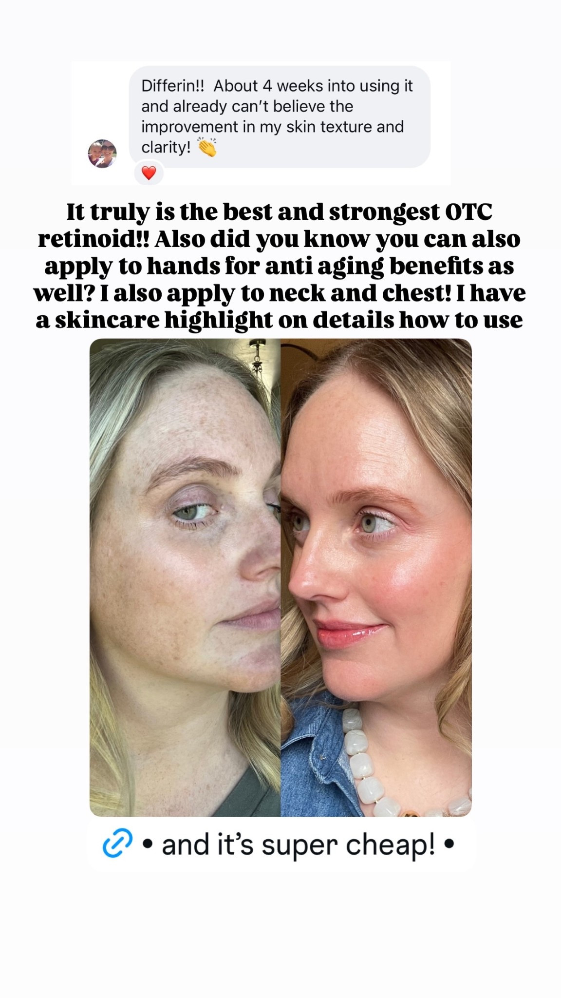 It truly is the best and strongest OTC retinoid!! Also did you know you can also apply to hands for anti aging benefits as well? I also apply to neck and chest! I have a skincare highlight on details how to use

#LTKmomlife #LTKselfcare