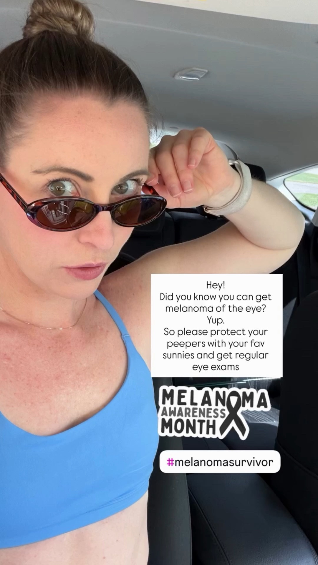 Melanoma can occur on the eye. Protect your peepers with your favorite sunnies 
(And how pretty is this bright blue sports bra?!)

#LTKootd #LTKdayinmylife #LTKmorningroutine