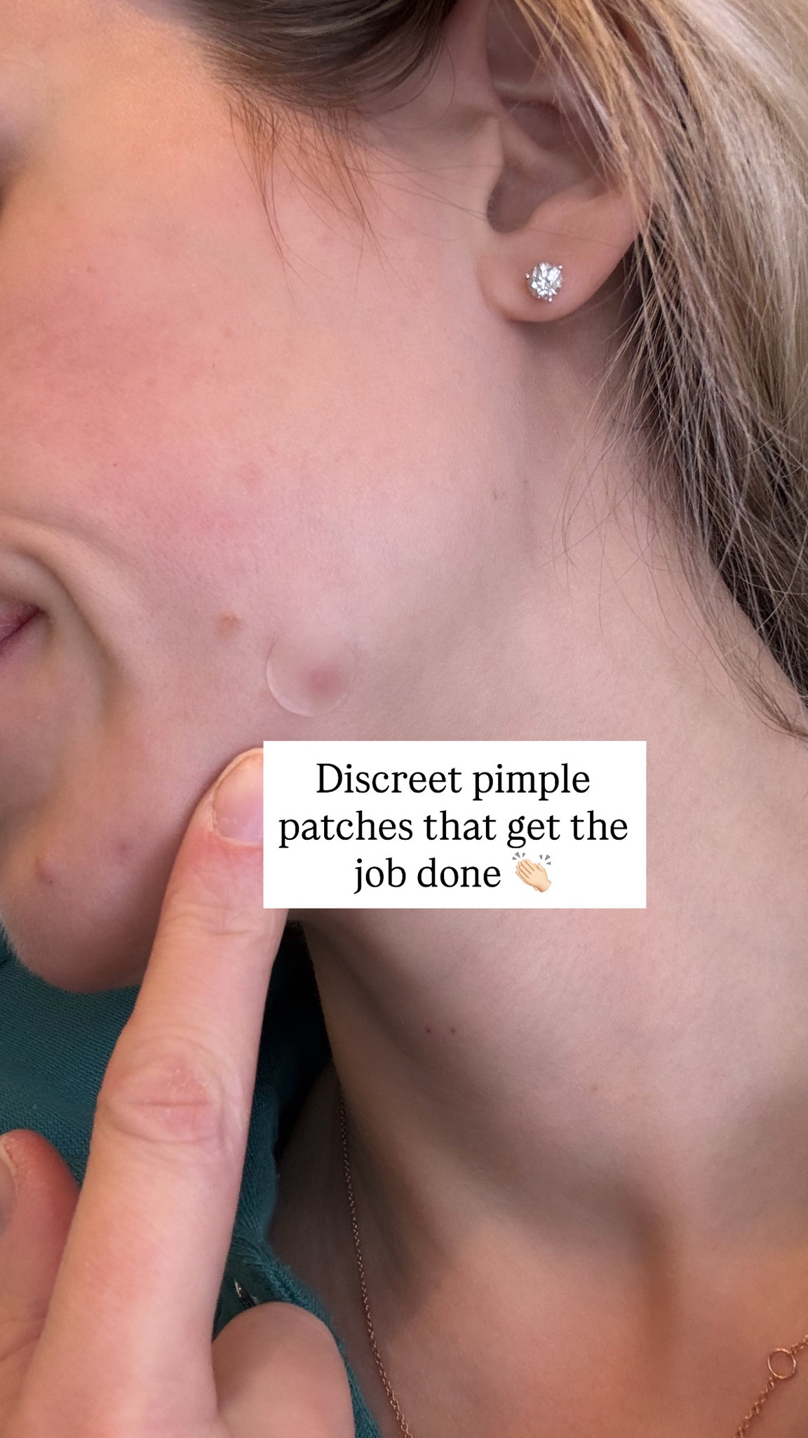 Love these blemish patches pimple spots acne blemishes makeup cosmetics beauty skincare cream anti-aging moisturizers face oil amazon beauty find

#LTKselfcare #LTKgrwm #LTKBeauty