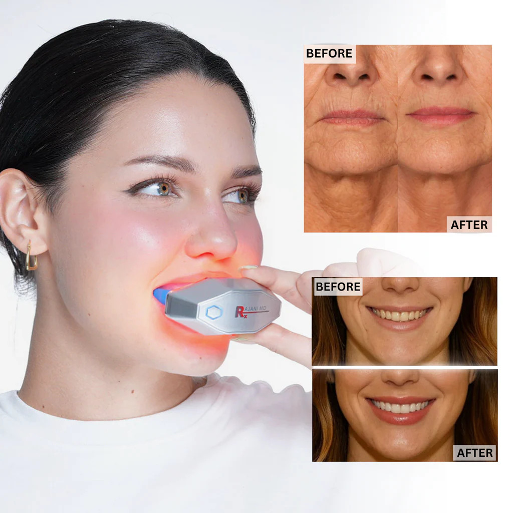 PlasmaGLO™ LED Lip and Mouth Device | Rajani MD