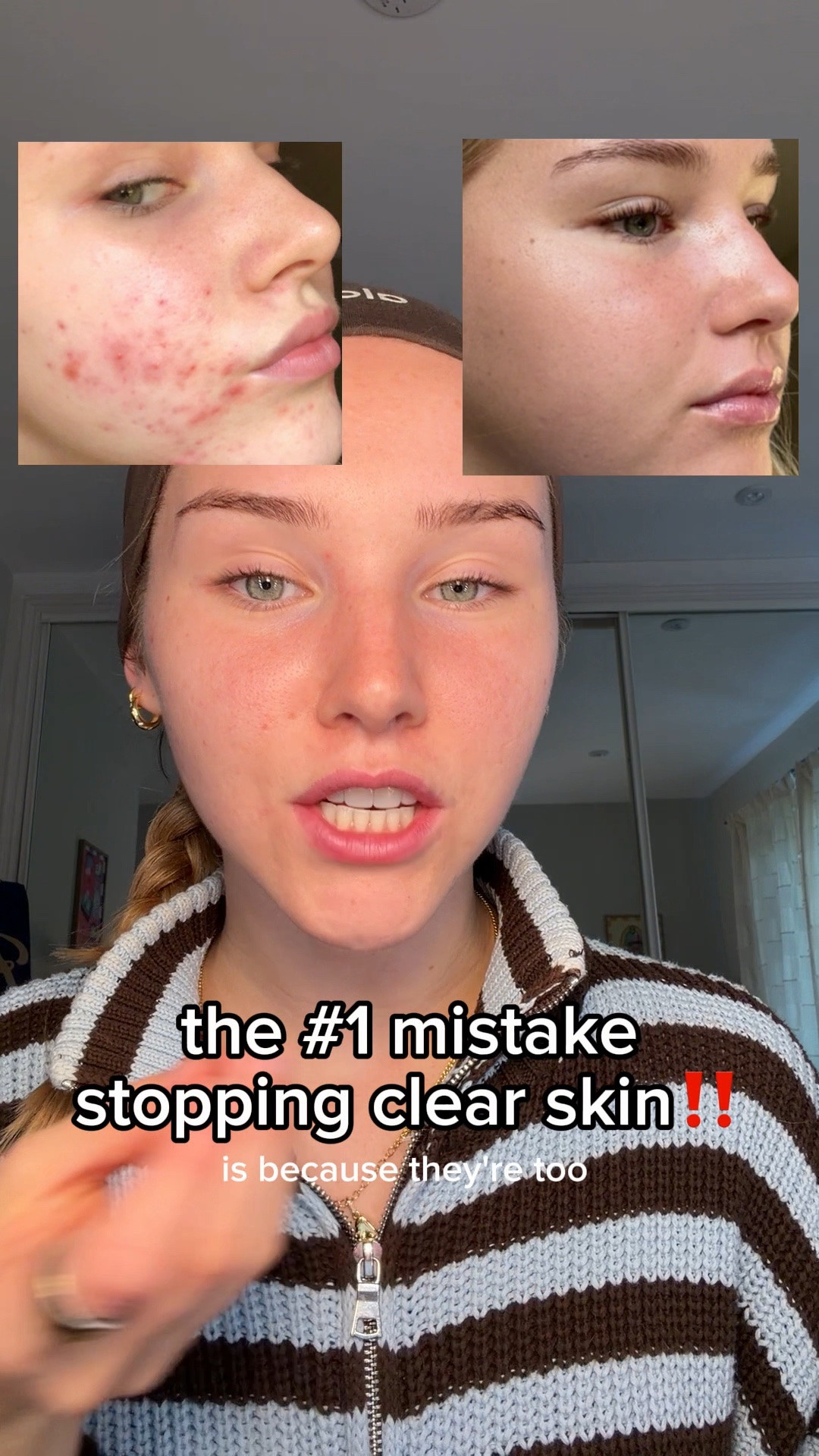 my acne evening routine! 
code LIFEWITHMILS gives ££ off everything!!💝💝