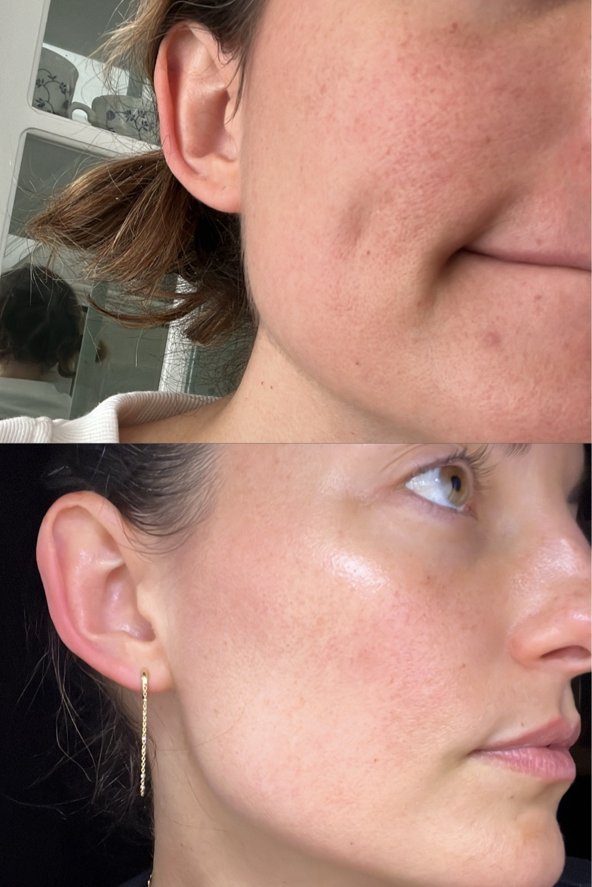 GLOWING & CLEAR SKIN: Products that took my skin from (top photo) to (bottom photo) in a few months. 
