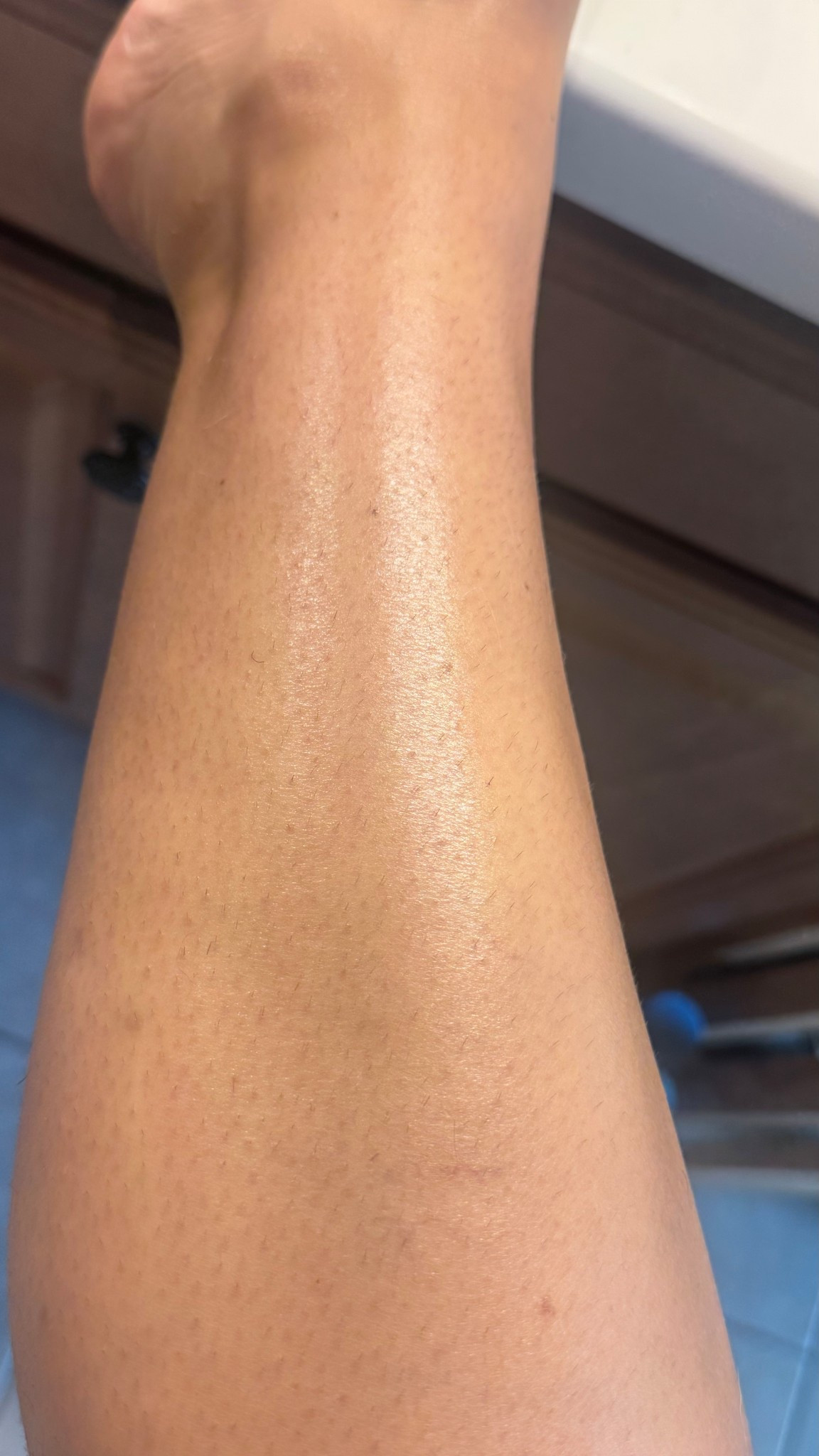 This is my unshaved leg (it’s been about 5 days). I have only used this oil 3 times and my unwanted hair is already growing in lighter. I wish I had taken a before pic bc I honestly didn’t think this oil would work to lessen my hair growth but wowww was I wrong!! Can’t wait to see what happens in another few weeks! 

Cyperus rotundus oil is an ancient remedy to unwanted hair growth and smoother skin. Before razors were invented, women used this to get rid of hair so it’s already had centuries of proof that it works  ✨ 

#LTKBeauty