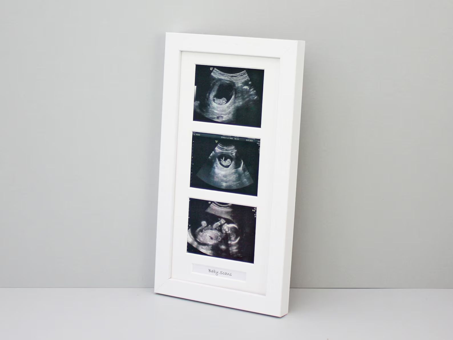 Baby Scan Multi Aperture Photo Frame | Etsy | Etsy (CAD)