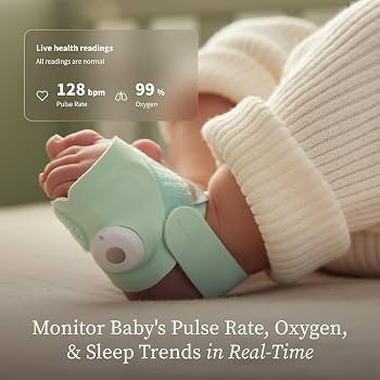 Owlet Dream Sock Smart Wearable Baby Monitor Tracks Heart Rate & Oxygen in Real Time Parents Rece... | Amazon (US)