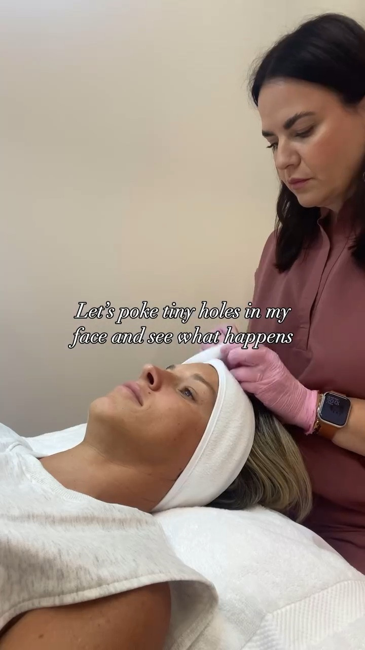 comment ✨SKIN JOURNEY✨ for the link to all @comoaesthetics details! I had my first ever micro-needling treatment to boost collagen & elastin in the face. 

Benefits include:
-Reduced appearance of acne scars, dark spots, wrinkles, and fine lines 
-More even skin tone and texture 
 -Thicker and tauter epidermis 
 -Reduced appearance of acne scars, dark spots, wrinkles, and fine lines 
 -More even skin tone and texture 
 -Thicker and tauter epidermis 
 -Minimized pore size 
 -Reduced visibility of cellulite 
 
3-6 months from now my skin will still be glowing! 

micro needle, micro needle treatment, skin pen, aesthetics, aesthetic spa, skin health, skin journey, skin tips, micro needling, derma-plane, self care, skin treatments, skincare, skin booster, skin glow, skin rejuvenation

#microneedling #dermaplaning #dermaplane