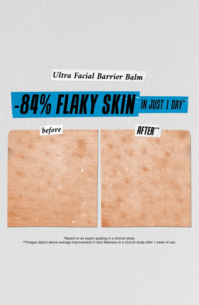 Kiehl's Since 1851 Stick to Hydration Gift Set $71 Value | Nordstromrack | Nordstrom Rack