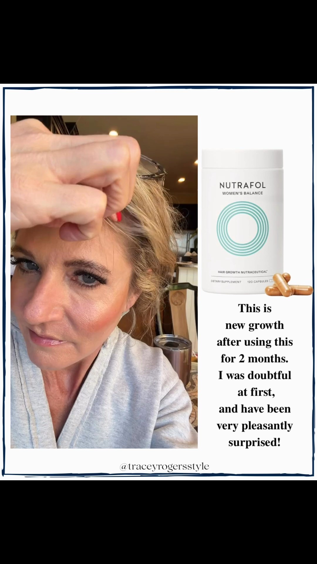 If you want real hair growth results, you need to try Nutrafol!

#LTKGiftGuide #LTKOver40 #LTKHoliday