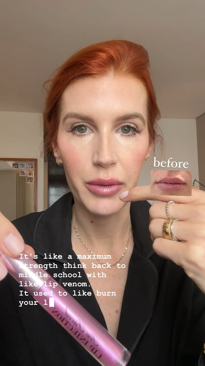 Who remembers “lip venom” from middle school? This is the new improved version!
Seriously looks like I just left the injector! 

#LTKU #LTKbeauty #LTKGiftGuide