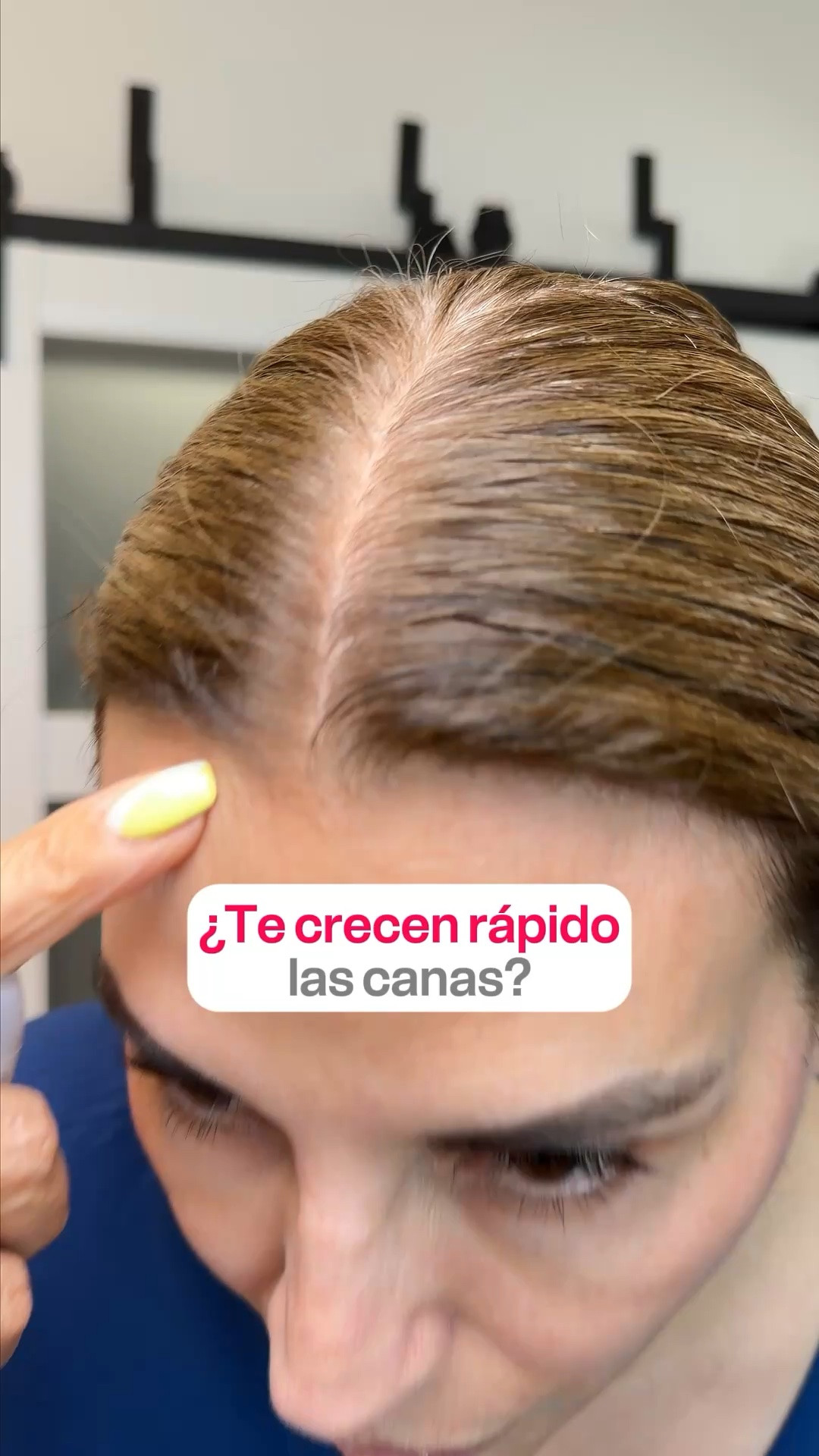 ¿Te crecen rápido las canas?

#LTKselfcare #LTKOver40 #LTKBeauty