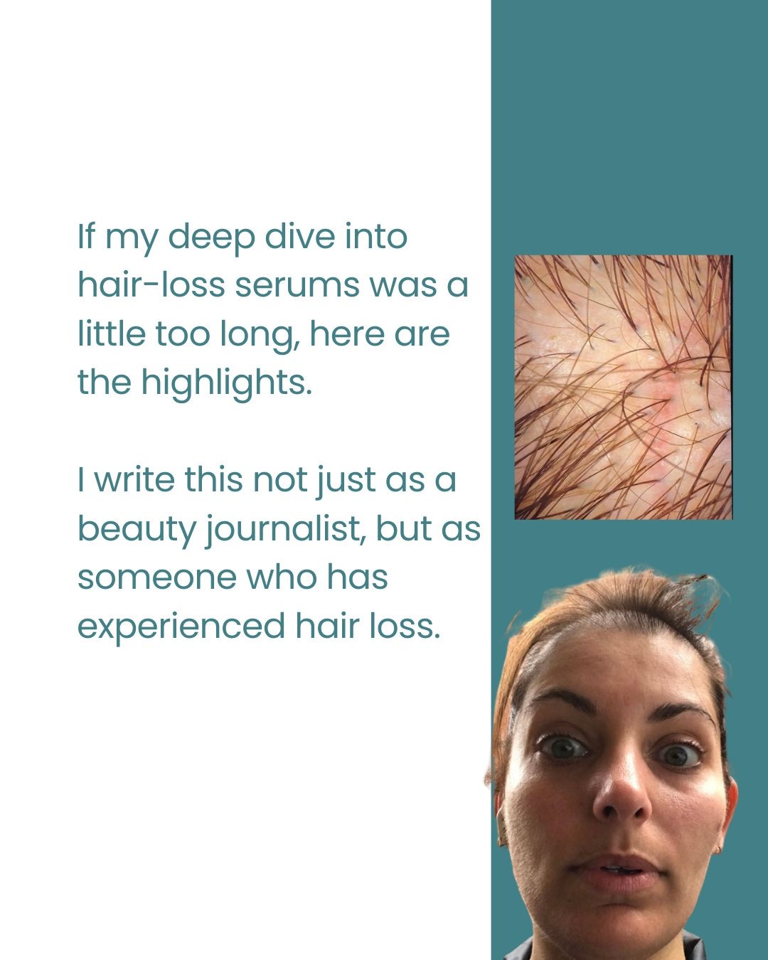 A quick round up of the hair loss serums I’ve been asked about most recently.

#LTKuk #LTKbeauty
