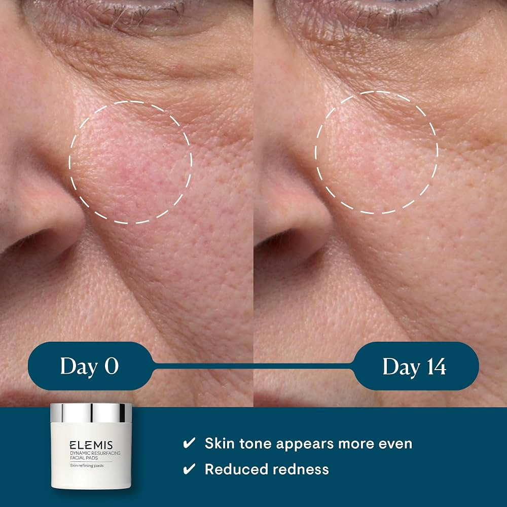 ELEMIS Dynamic Resurfacing Facial Pads, Gentle Textured Treatment Facial Exfoliating Pads | Amazon (US)