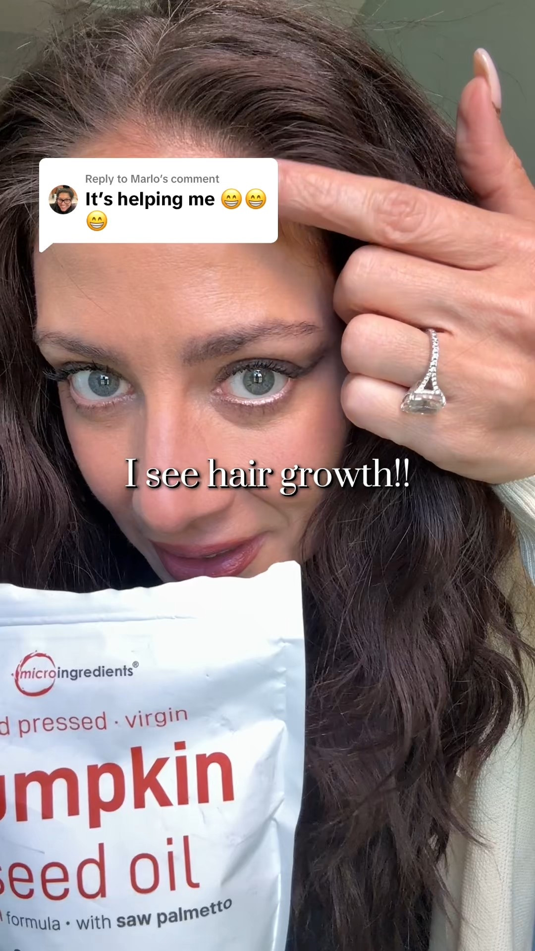 Pumpkin Seed Oil is growing me baby hairs

#hairloss #perimenopause #thinninghair #pumpkinseedoil