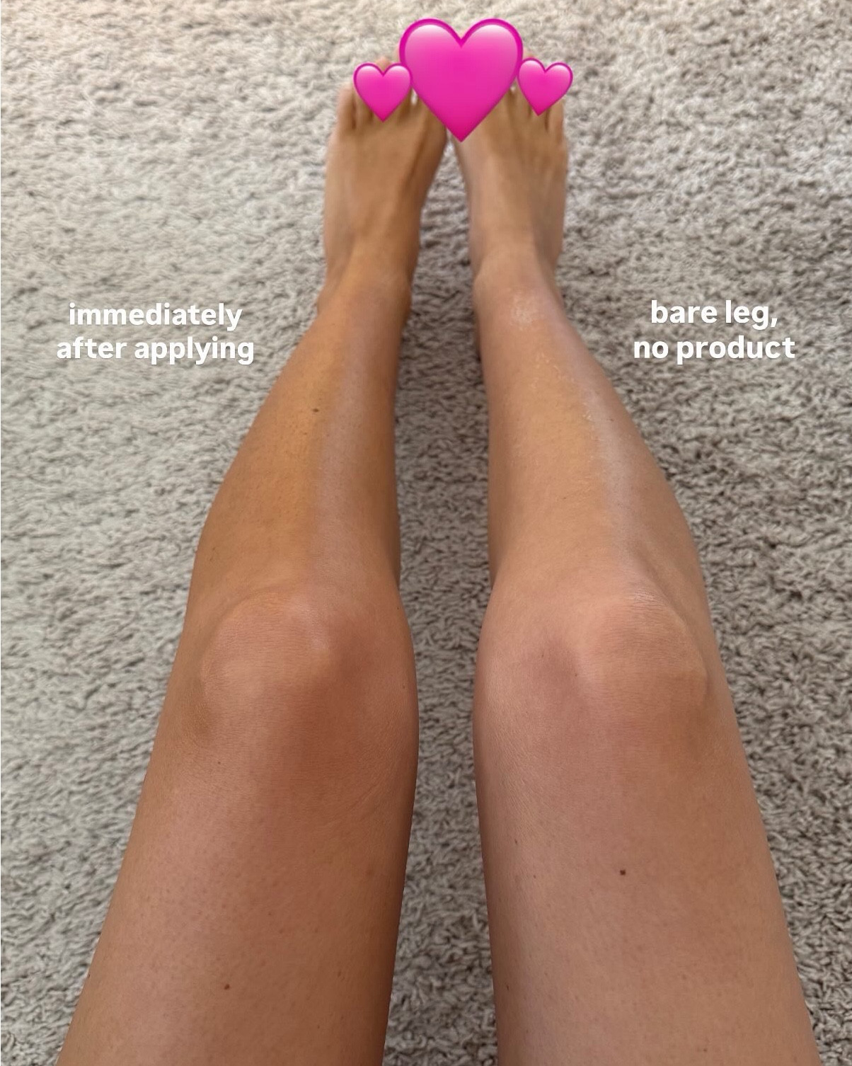 The 10 min tan results after a full 24 hours! For those of you who aren’t familiar, the concept of the product is that you can wash it off after 10 minutes, in immediately leaves you with a really pretty glow that continues to deepen over the next 6 to 8 hours, and then it is fully developed within 24! Truly such a hydrating pretty product that I’m still blown away by 

#LTKBeauty #LTKgrwm #LTKselfcare