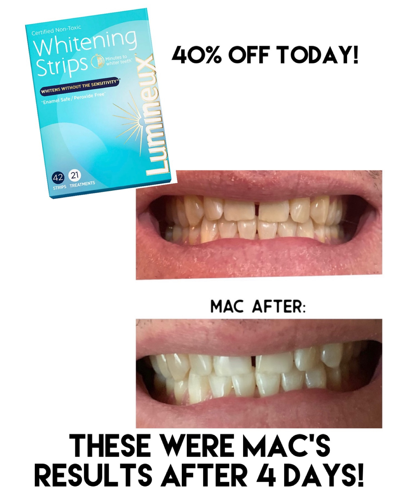 40% off today! ONLY whitening strips that don't cause teeth sensitivity for me!
.


#LTKsalealert #LTKbeauty