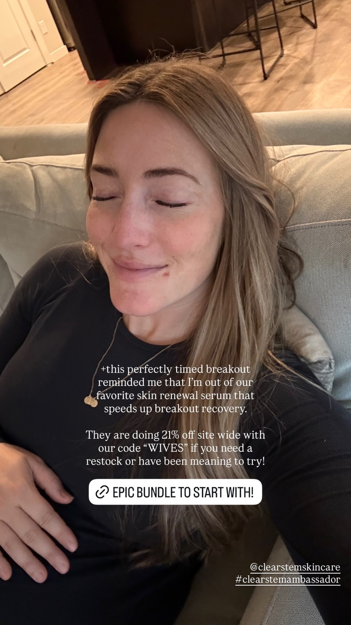 +this perfectly timed breakout reminded me that I’m out of our favorite skin renewal serum that speeds up breakout recovery. 

They are doing 21% off site wide with our code “WIVES” if you need a restock or have been meaning to try! @clearstemskincare 
#clearstemambassador