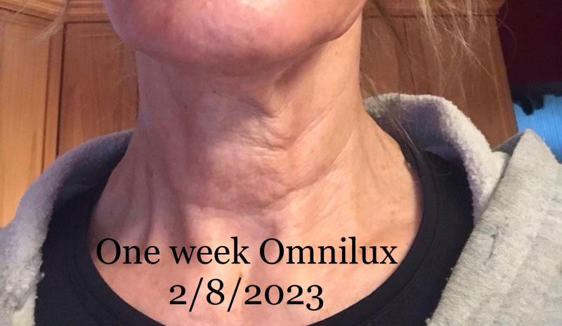 Contour Neck & Décolleté LED Device | Nordstrom