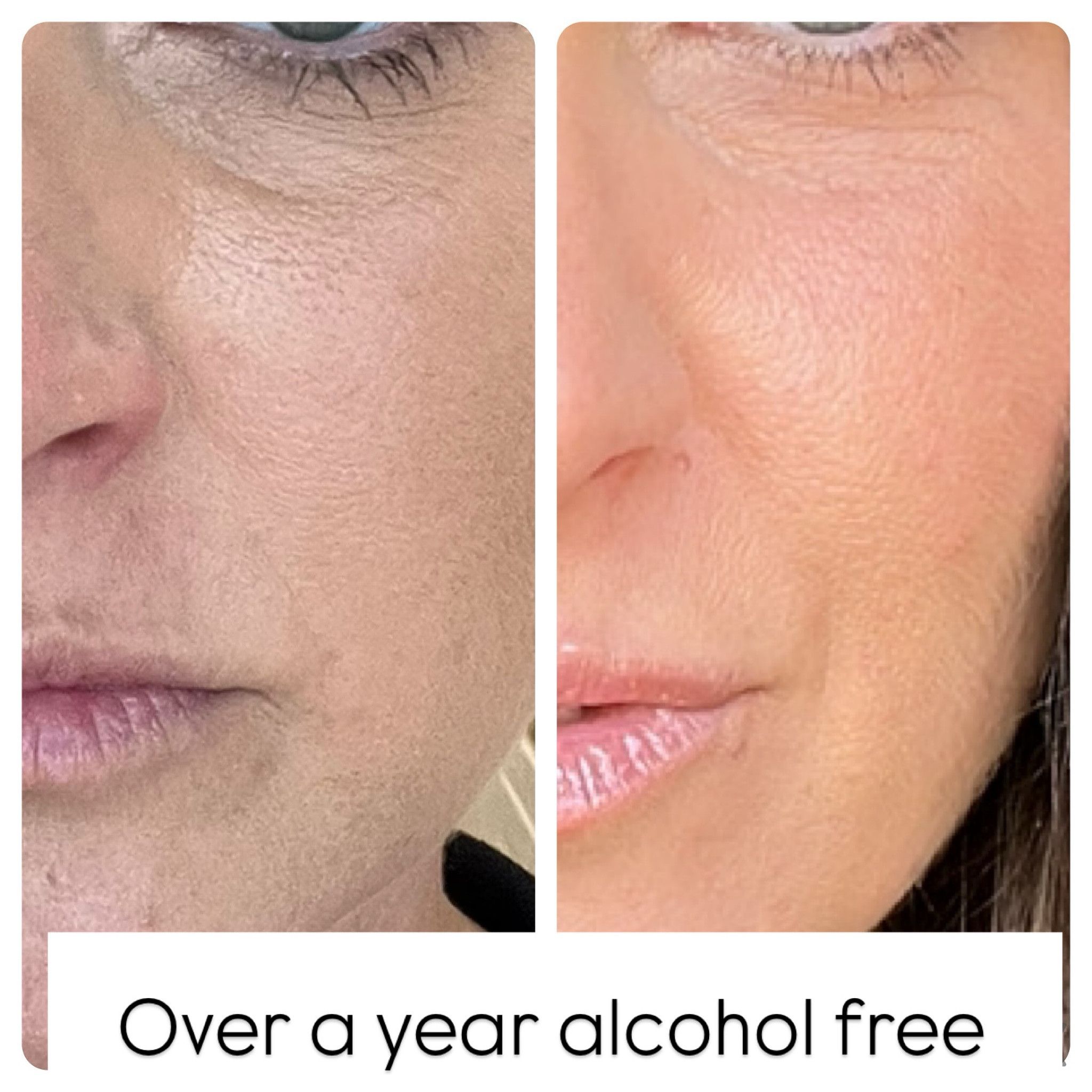 I have been asked a ton about my new skin care routine since I have become alochol free and my results have so positive so wanted to put together a post with all skincare 

#LTKOver40 #LTKBeauty