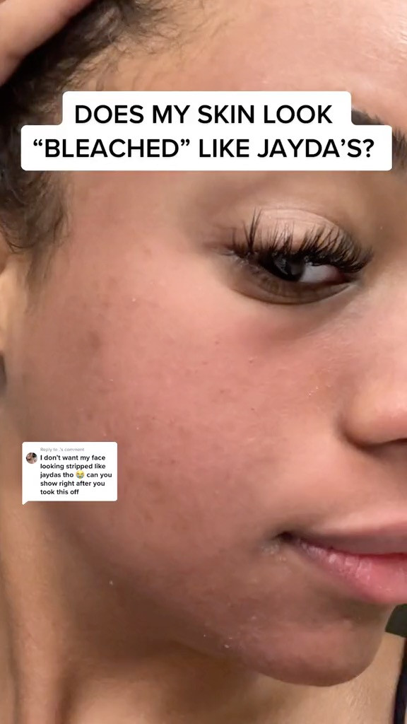 Replying to @.  Side note: in the lash clip I did have a little makeup on because I had to film a podcast interview today! But I think my skin looks the same color. I don’t think it looks like Jayda’s but lmk! #chemicalpeel #esthetician 

 