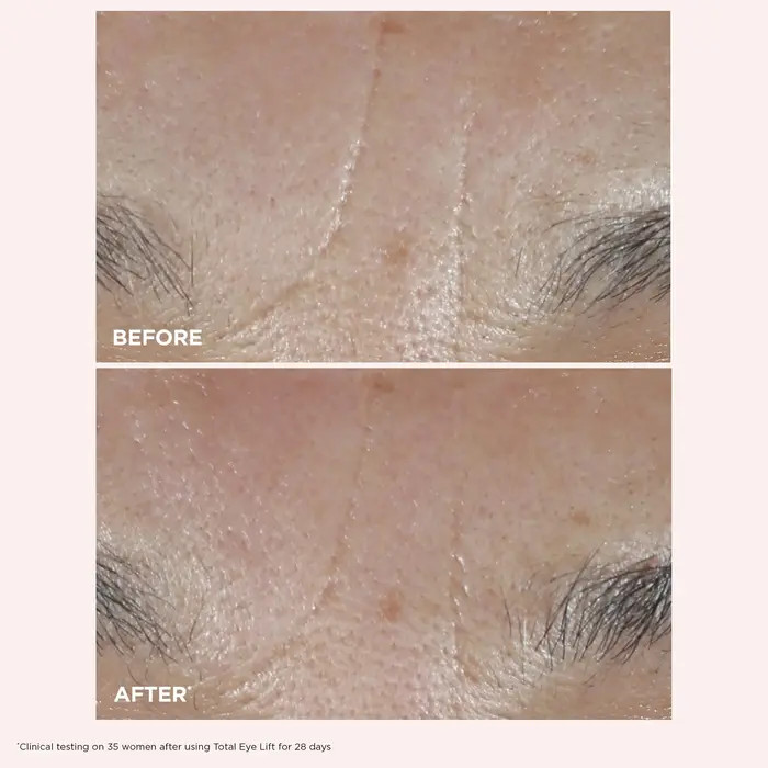 Total Eye Lift Refillable Eye Cream for Firming, Wrinkles, Dark Circles & Puffiness | Nordstrom