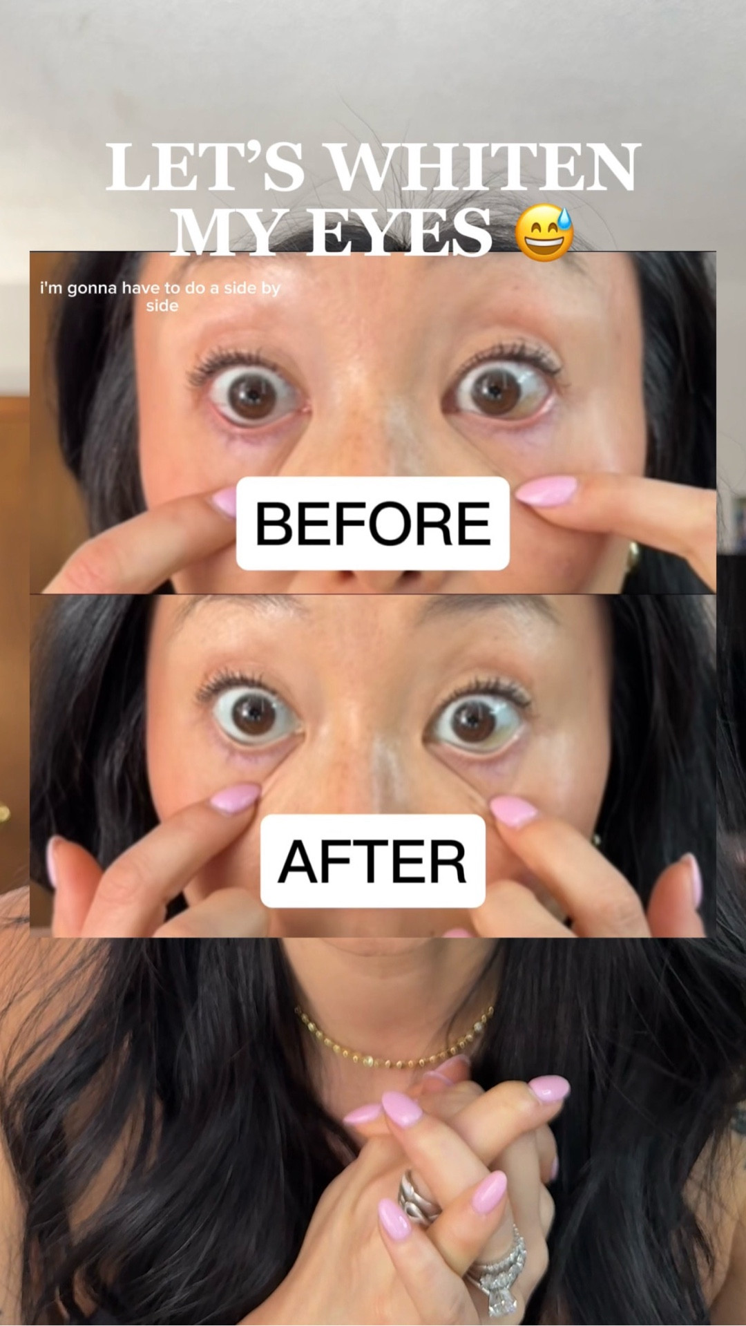 Ok these eye drops are actually so cool. Instantly make you look more awake too! 

#LTKBeauty #LTKSaleAlert #LTKselfcare