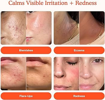 Tower 28 SOS Daily Rescue Facial Spray for Sensitive Skin, Hypochlorous Acid Spray Helps Reduce R... | Amazon (US)