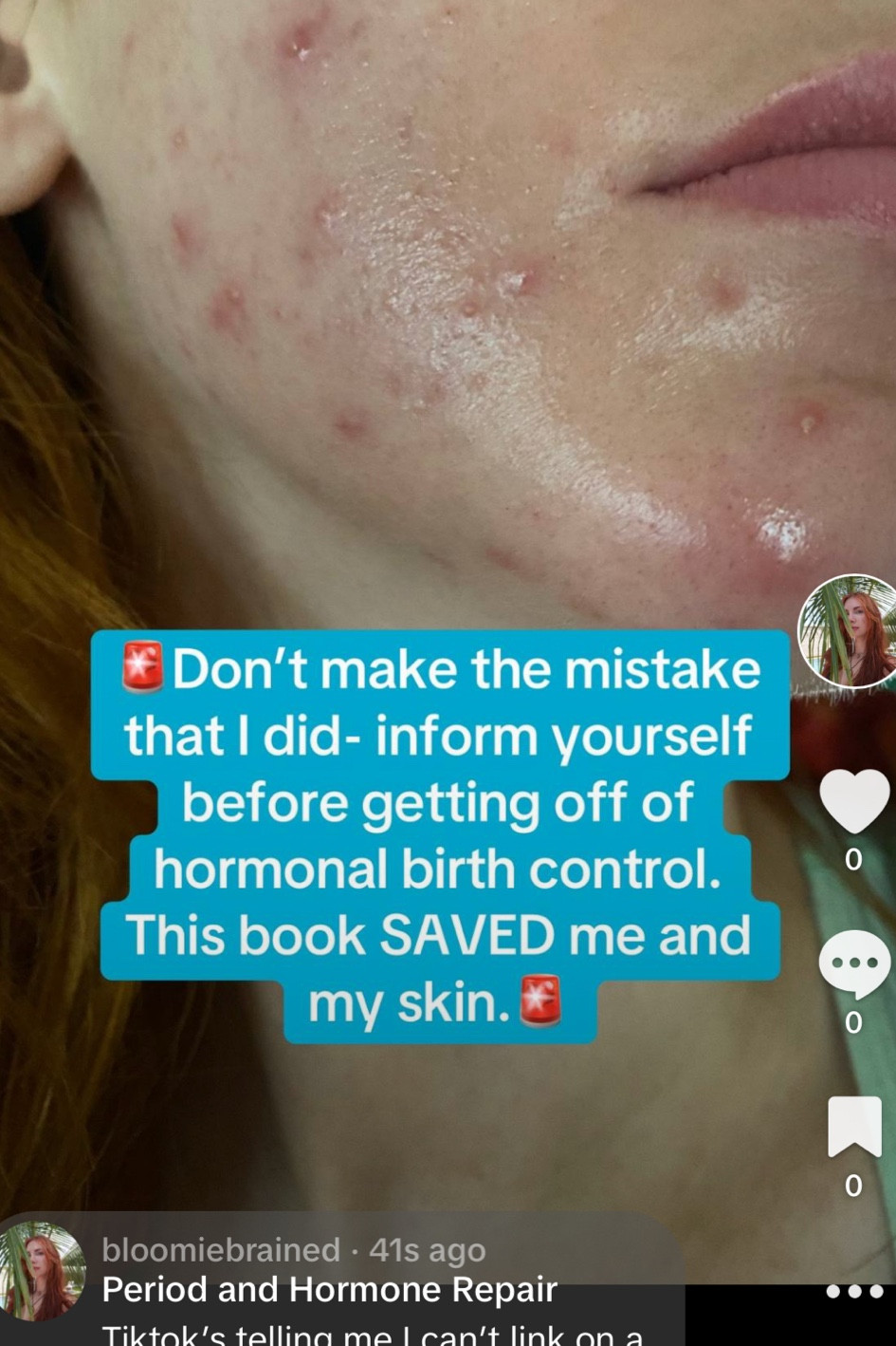 Read the full thread on my TikTok! This book saves lives 🙏🏼

#LTKWedding #LTKFindsUnder50 #LTKBeauty