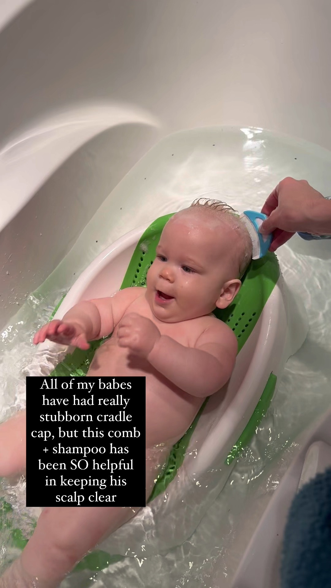 All of my go-to baby bath things, including the best cradle cap remedy I’ve found yet! 

#LTKfamily #LTKbaby #LTKfindsunder50