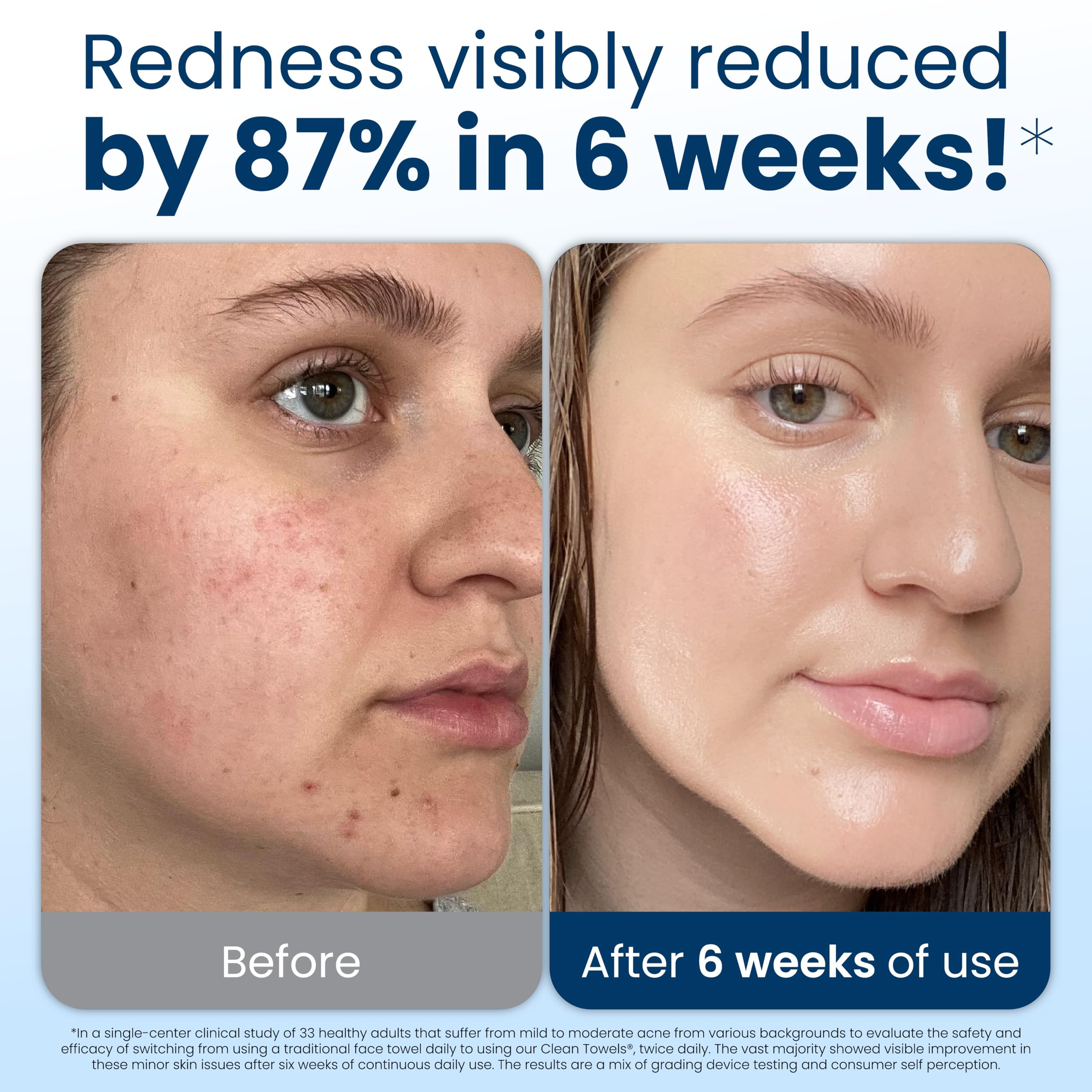 Clean Skin Club Clean Towels XL®, 100% USDA Biobased Face Towel, Disposable Face Towelette, Ecze... | Amazon (US)